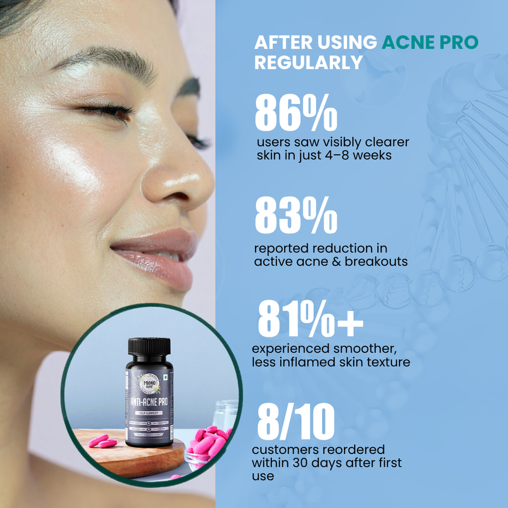 ANTI ACNE PRO