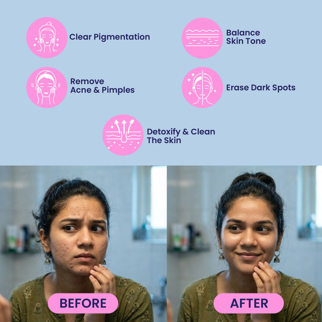ANTI ACNE PRO